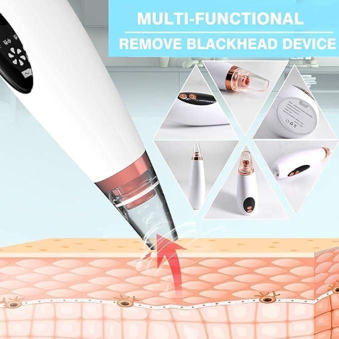 Herhaven 6 in 1 Multi-function Blackhead Remover