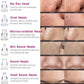 Herhaven 6 in 1 Multi-function Blackhead Remover