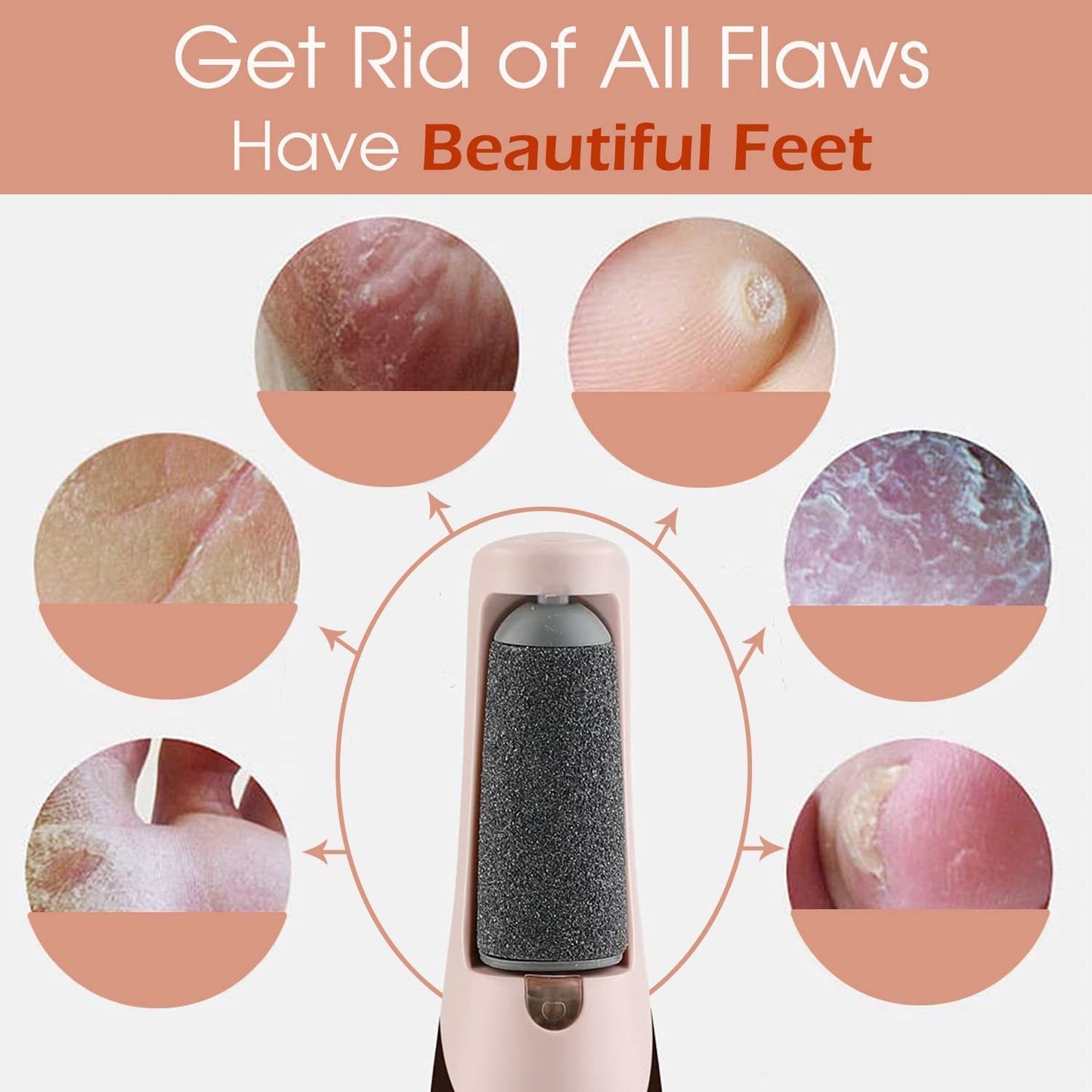 Herhaven Callus Remover