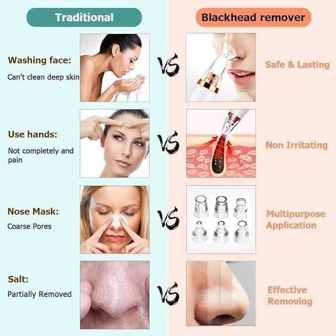 Herhaven 6 in 1 Multi-function Blackhead Remover